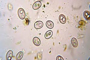 cocidiosis